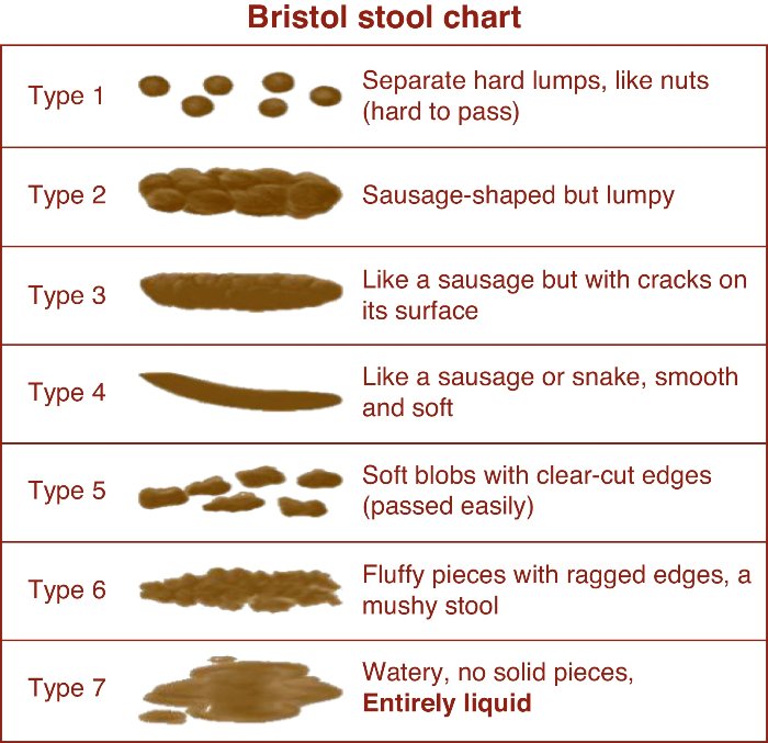 Fissure Diet Chart